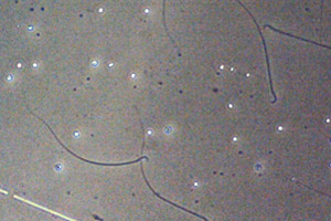 Рис. 4. Сперматозоиды крысы после экспонирования в условиях, воспроизводящих эффекты микрогравитации на Земле (фото из архива ИМБП)